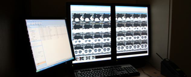 歯科医師の皆様へ インプラント術前CT検査
